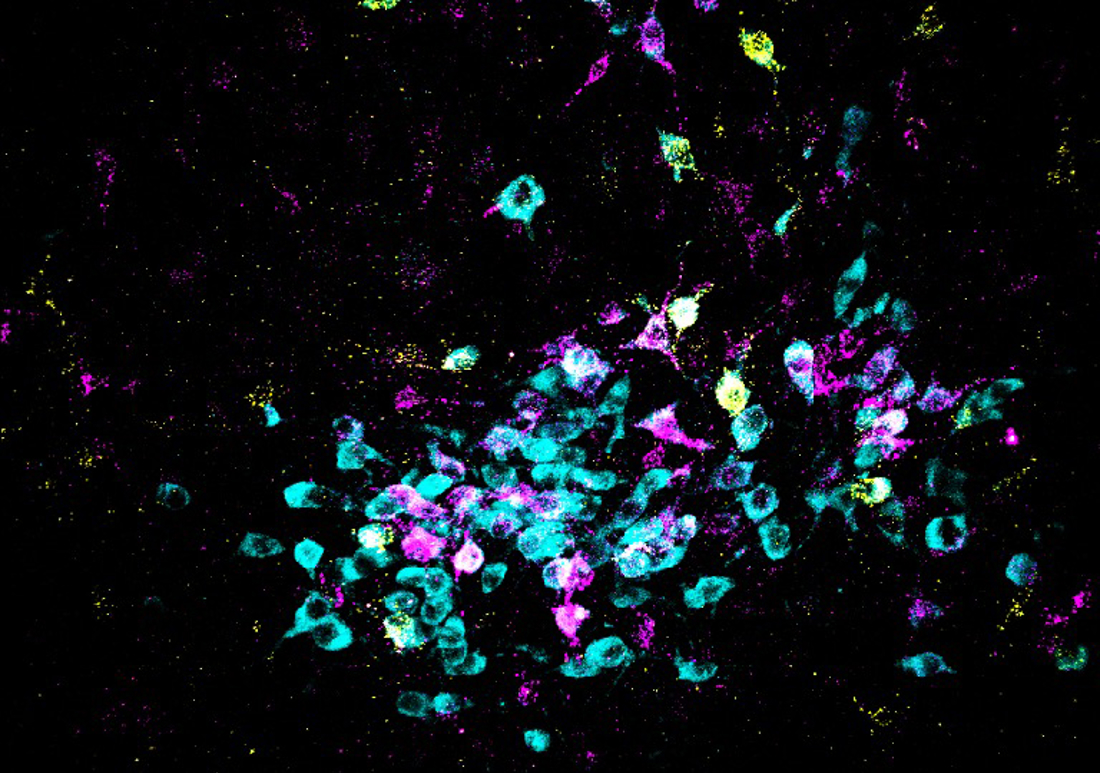 En la imagen, las neuronas aparecen en cian y los trazadores retrógrados, en amarillo y magenta. Fotografía facilitada por el Laboratorio Spitzer, UC San Diego. EFE