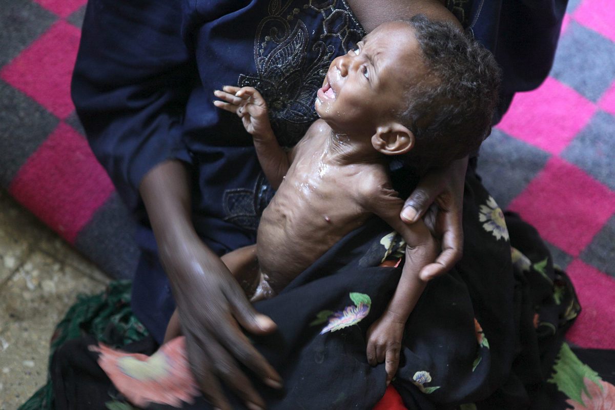 Foto archivo. Etiopía hambre. EFE/Irada Humbatova