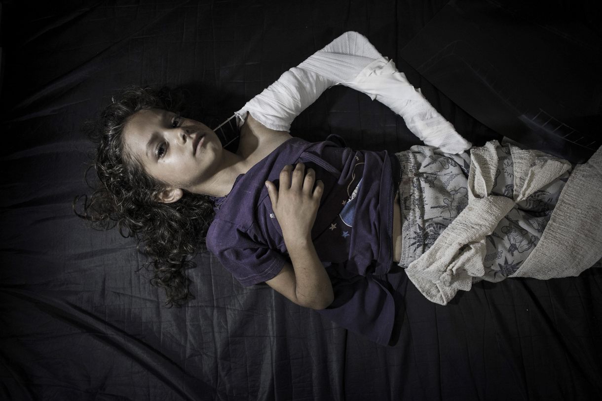 Imagen de archivo de una niña, herida en el bombardeo israelí a la escuela de la localidad de Beit Hanún, en el hospital de Kamal Adwan en Beit Lahiya en Gaza. (Foto de Oliver Weiken de la agencia EFE)