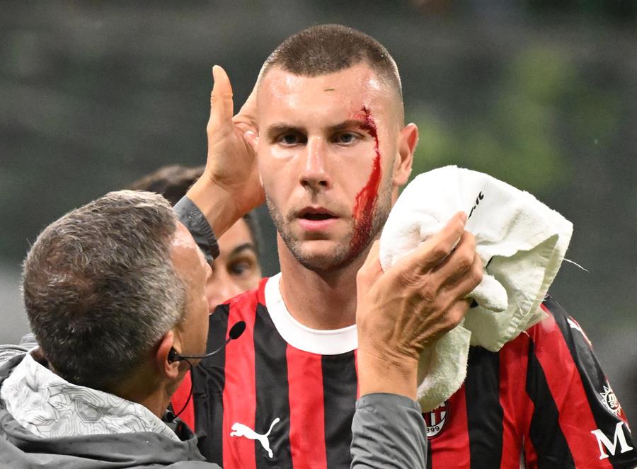 El jugador del AC Milan Strahinja Pavlovic es atendido por el médico durante el partido de la Serie A que han jugado AC Milan y Udinese en el Giuseppe Meazza en Milan, Italia. (Foto de EFE)