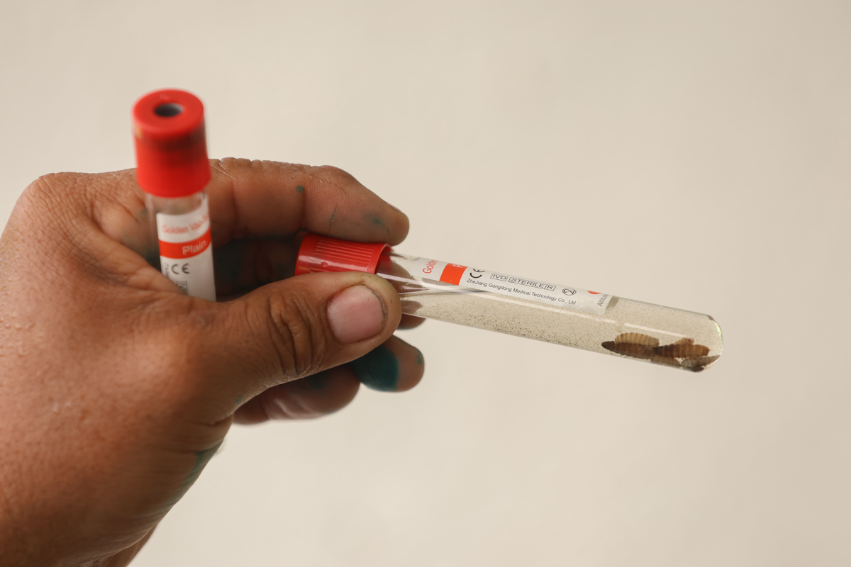 Fotografía del 22 de julio de 2025 de una persona sosteniendo una muestra del gusano barrenador extraída a un becerro en el municipio de Rio Bravo, Suchitepéquez (Guatemala). (Foto de Mariano Macz de la agencia EFE)