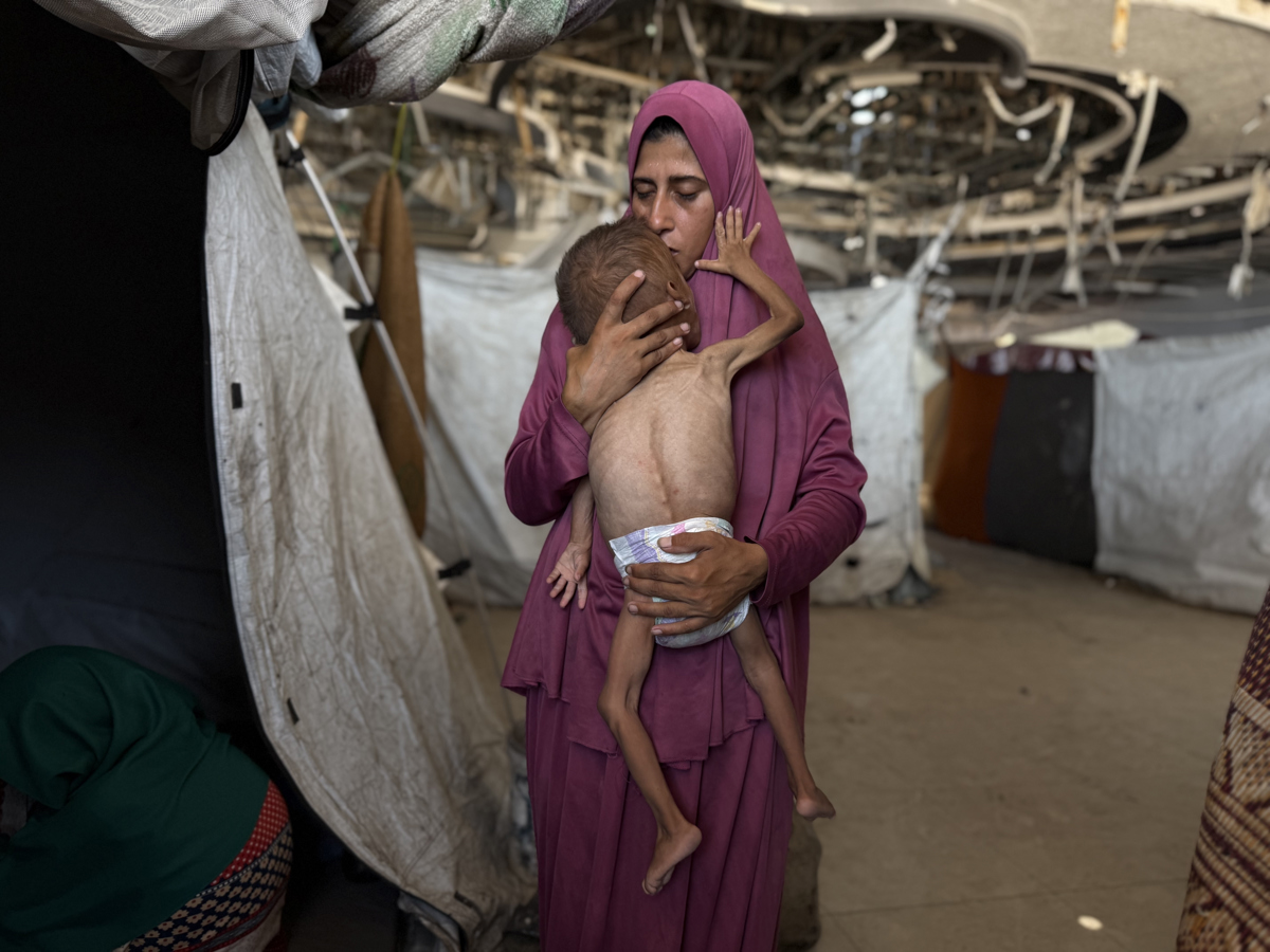 Un niño gazatí de 18 meses, de cuerpo esquelético, en brazos de su madre en una imagen del 26 de julio de 2025. (Foto de Ahmad Awad de la agencia EFE)