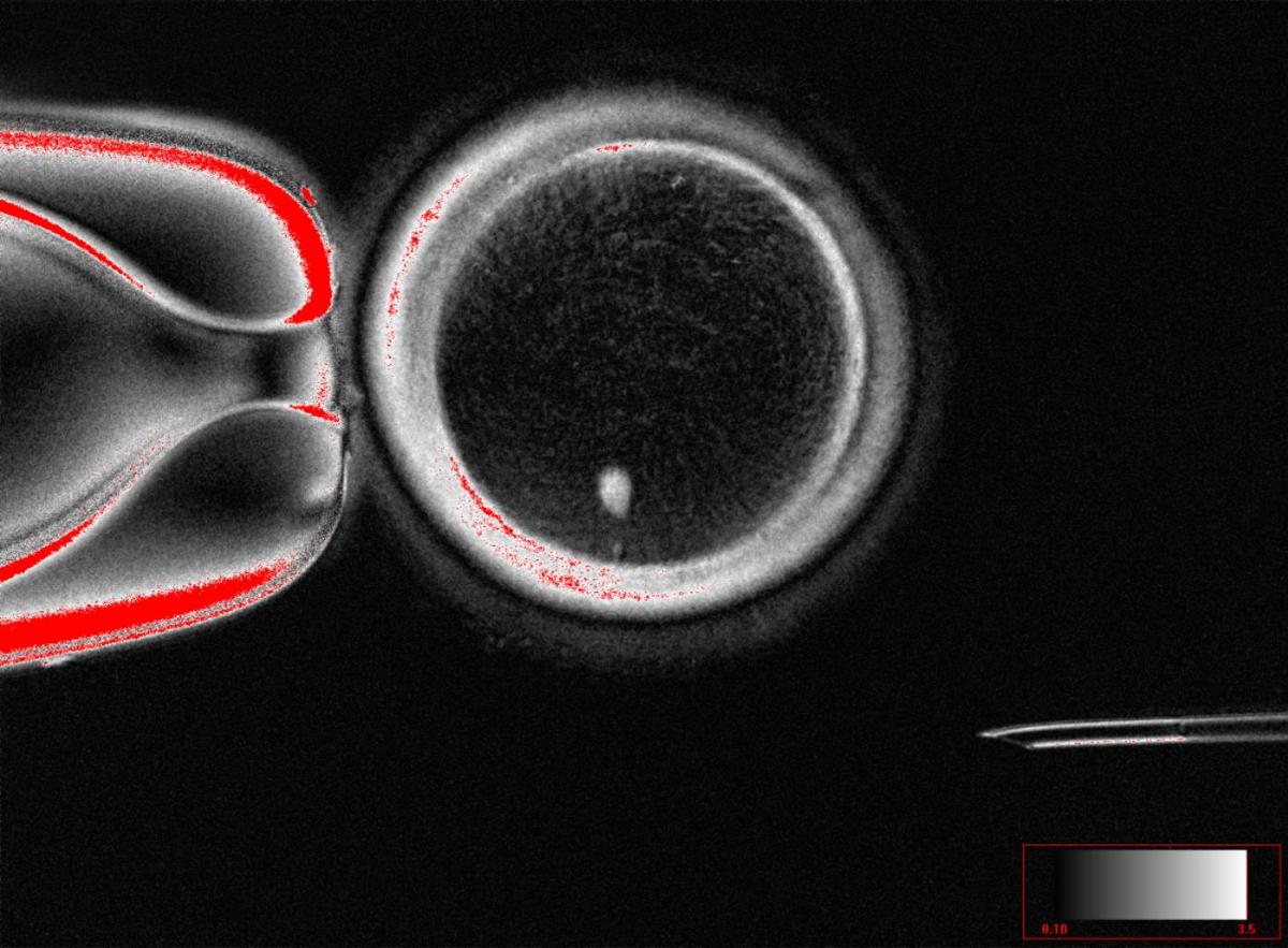 Ovocito humano con transferencia nuclear de células somáticas con huso visible (punto brillante en el interior) antes de la fecundación. (Crédito: Mitalipov laboratory)